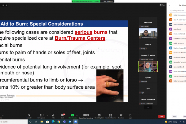 Online training workshop for Health and safety titled “First Aid for Burns “ 2021-2022 _7
